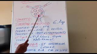 Glomerulonefritis Parte 1  Nefrología [upl. by Turley697]