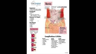 Inguinal amp Femoral hernia repair [upl. by Sisi]