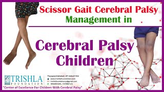 Scissor Gait Cerebral Palsy Management in Cerebral Palsy Children  Trishla Foundation [upl. by Ezara]