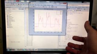 RealTime EMG Signal Processing  Live Muscle Activity Analysis [upl. by Eckart]