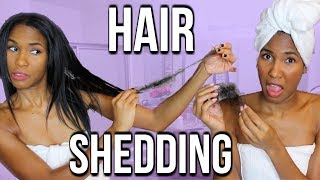 5 BEST PRODUCTS FOR HAIR SHEDDING HAIR LOSS TIPS [upl. by Icyak]