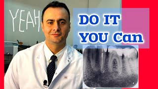 Secrets of Mastering Calcified Molar Endodontics [upl. by Eoin675]