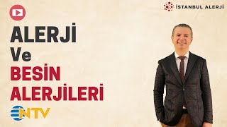 Alerji ve Besin Alerjileri  Prof Dr Ahmet Akçay  Adım Adım Sağlık Programı [upl. by Wivina]