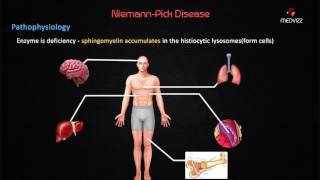 NiemannPick Disease  Case Based discussion  Usmle step 1 Biochemistry [upl. by Melissa855]