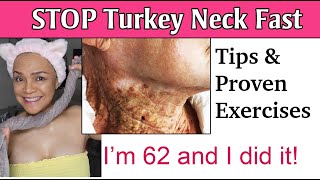 The PROVEN Neck and Jowl Exercise That Everyone Is Talking About [upl. by Maretz527]