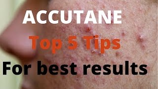 Accutane 5 tips by Dermatologists [upl. by Eisak]