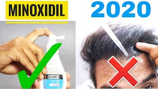 How to use Minoxidil properly  Use this way to get best Minoxidil Results [upl. by Aihsad572]