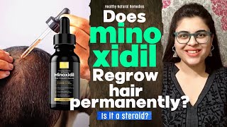 Does Minoxidil Regrow hair permanently Minoxidil side effects Minoxidil results Hair fall [upl. by Rushing]