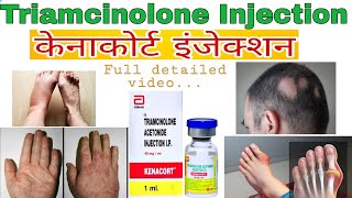 Kenacort injection uses  Triamcinolone injection uses  KENACORT INJECTION  how to use Kenacort [upl. by Yevreh98]