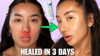 HOW I HEALED MY SKIN USING KBEAUTY 😍 REPAIR YOUR SKIN BARRIER [upl. by Ertha]