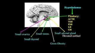 Excitotoxins Neurotoxins amp Human Neurological Disease Lecture  Dr Russell Blaylock [upl. by Neroled265]