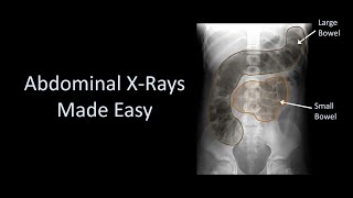 Cases in Radiology Episode 1 neuroradiology CT MRI [upl. by Mcclish]