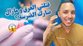 قتلتي العرق و مازال ضارك الضرسة ؟واش عادي أو لا؟ [upl. by Arzed]