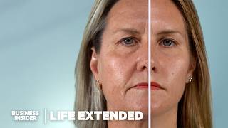 Scientists Are Closer Than Ever To Reverse Aging How Does It Work  Life Extended [upl. by Yelrebma]