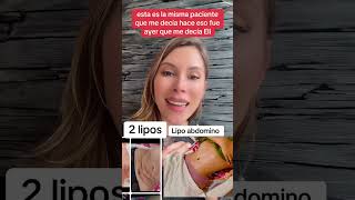 Lipo o abdominiplasticsurgery cirugiaplasticasegura youtubeshorts mujeres cirugiasplasticas [upl. by Yliab375]