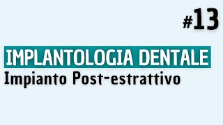 Implantologia Dentale  Impianto Postestrattivo [upl. by Alyakcim]