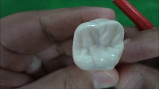 Maxillary Permanent First Molar Morphology [upl. by Euqnomod842]