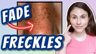 HOW TO FADE FRECKLES Dr Dray [upl. by Finnegan]