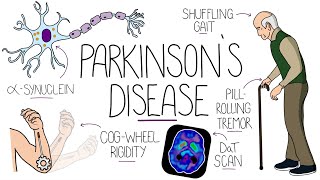 Understanding Parkinsons Disease Including Direct and Indirect Pathways [upl. by Adner]