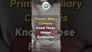 Primary Biliary Cirrhosis Hidden Symptoms cirrosis gastroenterologist viralshorts doctor [upl. by Aivin]