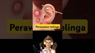 Perawatan Telinga  ASMR viralvideo trending shortvideo [upl. by Ioved]