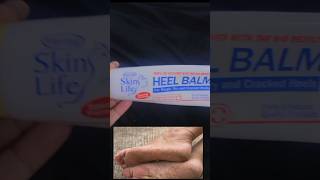 Foot care skin life heel balmbeauty skincareproduct [upl. by Clift139]