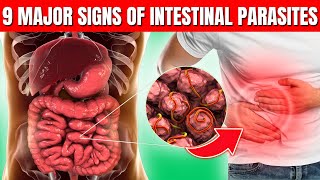 9 Major Signs of Intestinal Parasites and How to Treat Them [upl. by Ahcire]