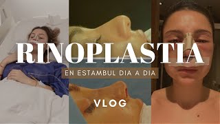 MI RINOPLASTIA EN ESTAMBULTURQUIA experiencia  VLOG DIA A DIA  rhinoplasty experience [upl. by Icat152]