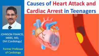 Causes of heart attack and cardiac arrest in teenagers [upl. by Naples]