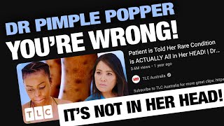 Calling Out Dr Pimple Popper  Mysterious Rash Prurigo Nodularis [upl. by Arocet]