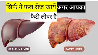 Eat these fruits only if you have fatty liver FRUITS FOR FATTY LIVER  Bhakti Food [upl. by Lael]