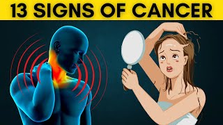 See a doctor immediately if you have these early signs of cancer [upl. by Oinimreh]