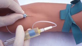 Performing a venipuncture using a butterfly needle [upl. by Yajnas145]