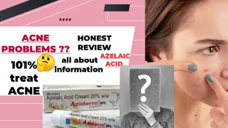 Aziderm CreamAziderm Cream Review  Azelaic acidMelasma amp Acneacne spot HyperpigmentionRosacea [upl. by Sonaj949]