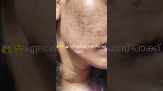 😱ഏലാദി ചൂർണ്ണം ഫേസ് പാക്ക് Day 7 facepackforacne facepackforglowingskin facepackforteenagers [upl. by Airakaz]