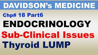 Davidsons Medicine Chp18 Part6  Endocrinology  Thyroid LUMP  Subclinical Thyroid Issues [upl. by Alliuqa885]