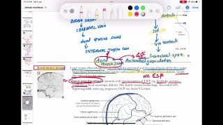 Dural venous sinuses anatomy and physiology neurology 43  First Aid USMLE Step 1 in UrduHindi [upl. by Akalam]