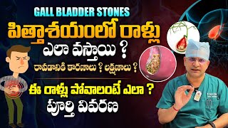 ఈ లక్షణాలు ఉంటే జాగ్రత్త  Dr Movva Srinivas About Gallbladder Stones Symptoms  Telugu Health Focus [upl. by Pavier]