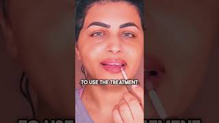 Get plump lips with this natural treatment shorts howtoplumplips naturalbeauty lipcare [upl. by Fokos]