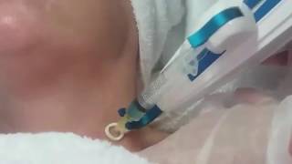 Mesotherapy using a mesogun Pistor Eliance  treating the neck area [upl. by Arther577]