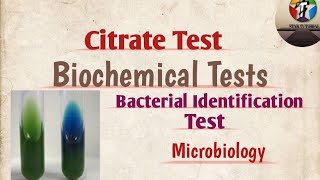 Citrate Test ll Biochemical Tests ll Bacterial identification test ll Microbiology [upl. by Nama196]