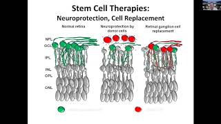 Regeneration and stem cell transplantation as treatment for optic neuropathies [upl. by Nilsoj903]