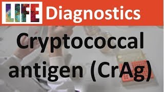 Cryptococcal antigen CrAg testing  Biosynex CryptoPS [upl. by Ajit]