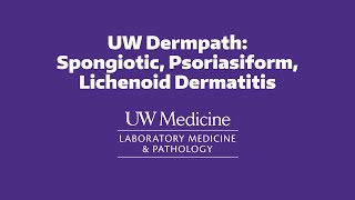 UW Dermpath Spongiotic Psoriasiform Lichenoid Dermatitis [upl. by Jews570]