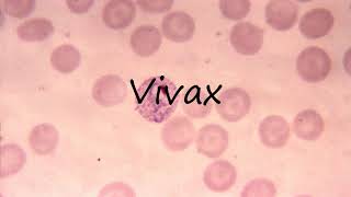 How to Pronounce Vivax [upl. by Aerbma]