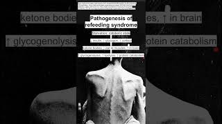 Pathogenesis of refeeding syndrome [upl. by Arec667]