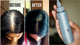 How to increase volume amp density of hair  Amways Satnique Scalp Tonic Review  Kavya K [upl. by Nilyam]