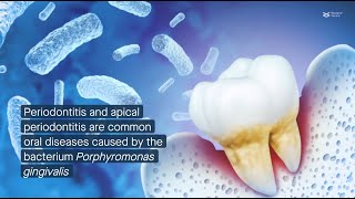 CXXC5 promotes cementogenesis protects against periodontitis by supporting mitochondria formation [upl. by Ahc568]