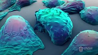 Nanoparticlebased drug delivery in the fight against cancer [upl. by Artined132]