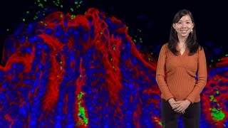 Julie Huang Stanford U H pylori finds its home [upl. by Adnarrim433]